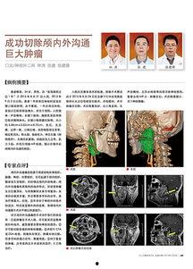 脑科肿瘤爆料案例最新,最新爆料揭示治疗挑战与希望